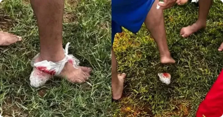 Ataques de piranhas no Rio Paraguaçu reacendem alerta entre banhistas na Bahia