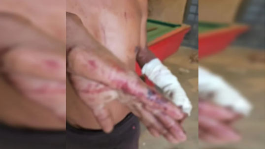 Homem é brutalmente agredido a golpes de facão pelo próprio filho