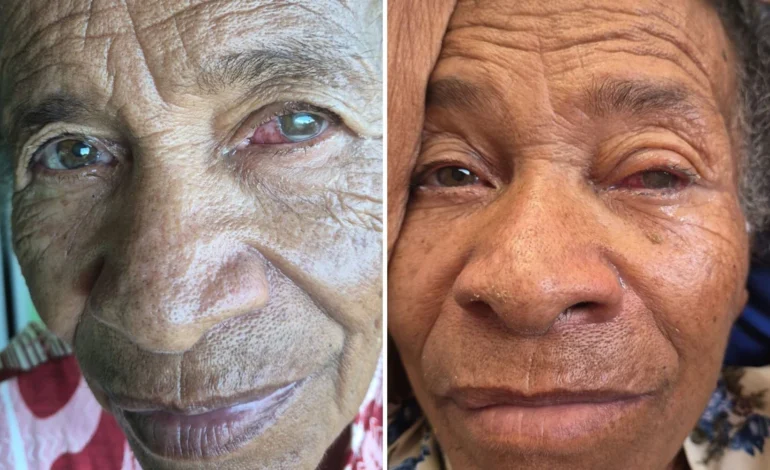 Mutirão oftalmológico deixa idosa cega de um olho na Bahia